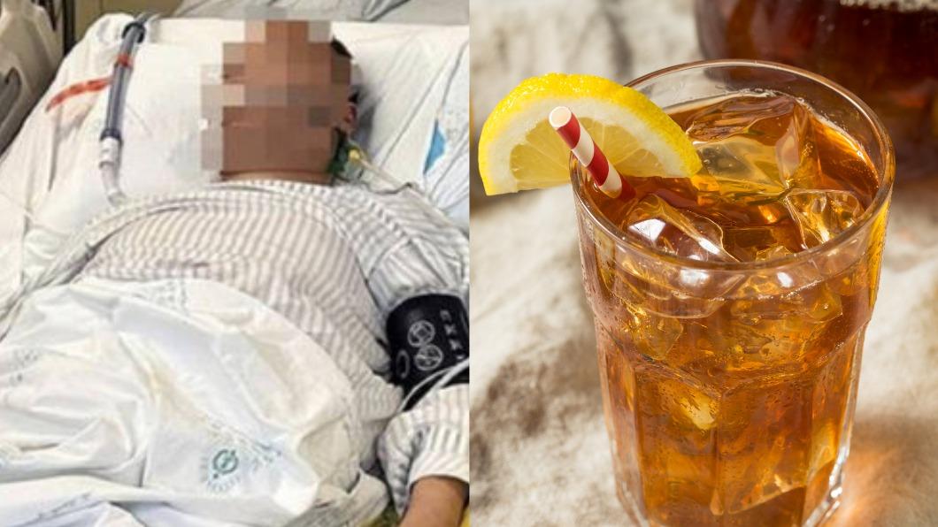 「冰鎮檸檬茶」惹禍?46歲男飲用後劇烈腹痛 急送ICU搶救