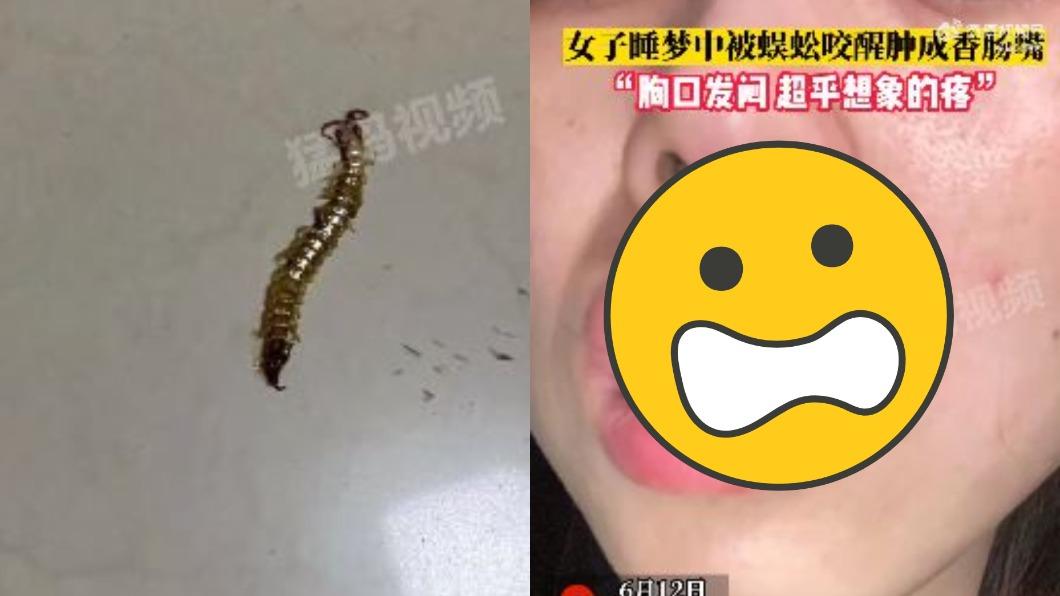 熟睡遭蜈蚣咬一口!她驚醒「蜜唇1秒變香腸」 急衝醫院保命