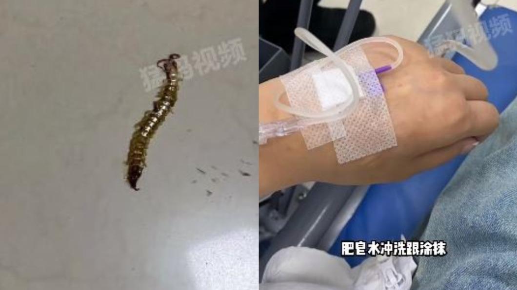 女子因為具備醫學背景,故在被蜈蚣咬後立刻用肥皂水沖洗傷口。(圖/翻攝自微博)