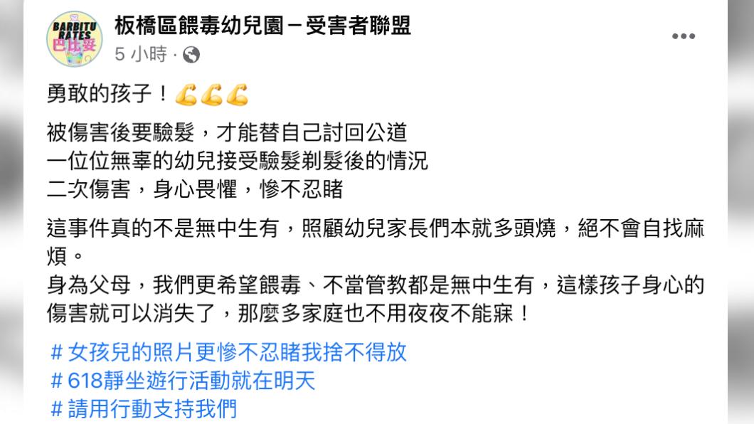 幼童剃髮檢驗,頭頂卻光了一整片,有家長認為是二度傷害。(圖/翻攝臉書)