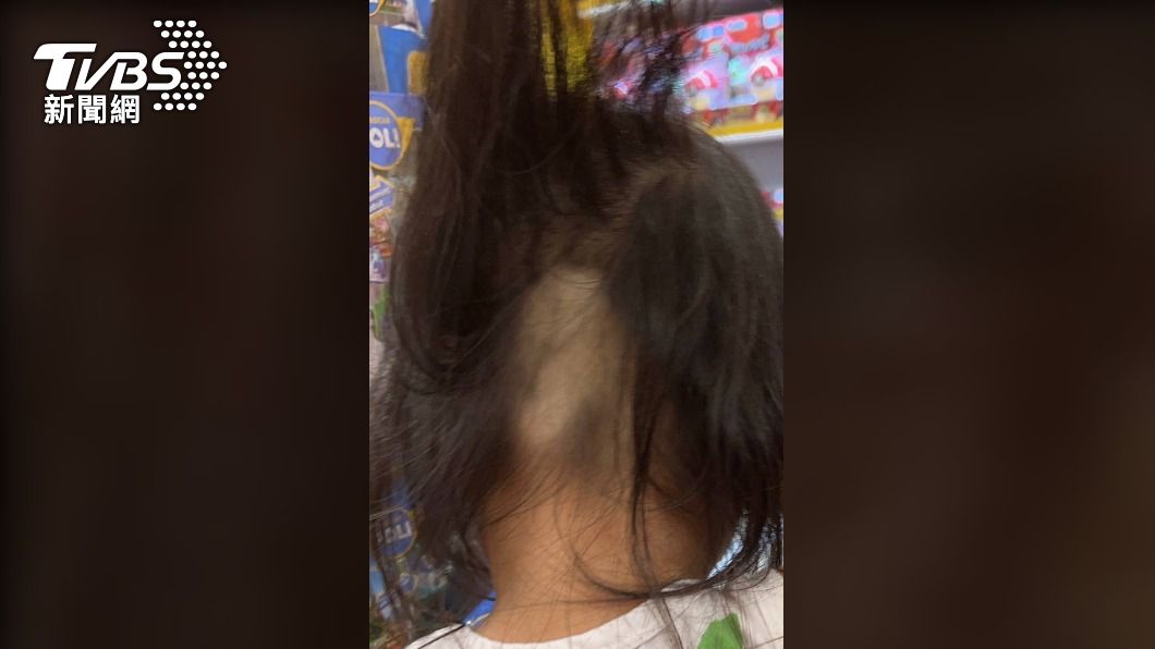 幼童剃髮檢驗,卻被剃光了一大塊。(圖/家長授權、王薇君提供)