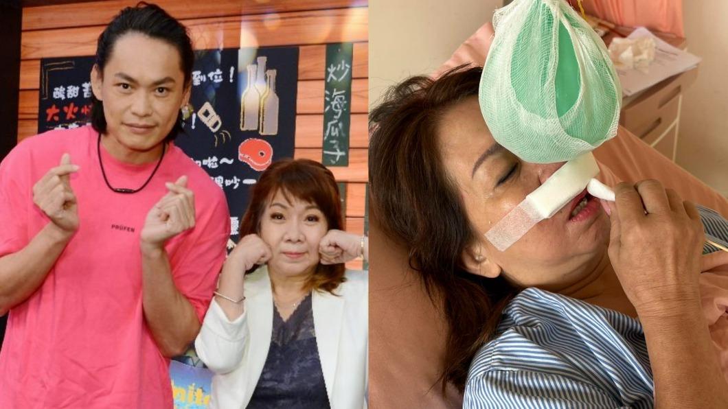 萁媽健康出狀況！整日昏沉急動刀　黃鐙輝曝這警訊：恐失智中風
