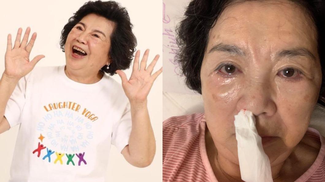 80歲國民阿嬤遭爆死訊！首露面嗆莫名其妙　曝「病危通知」實情