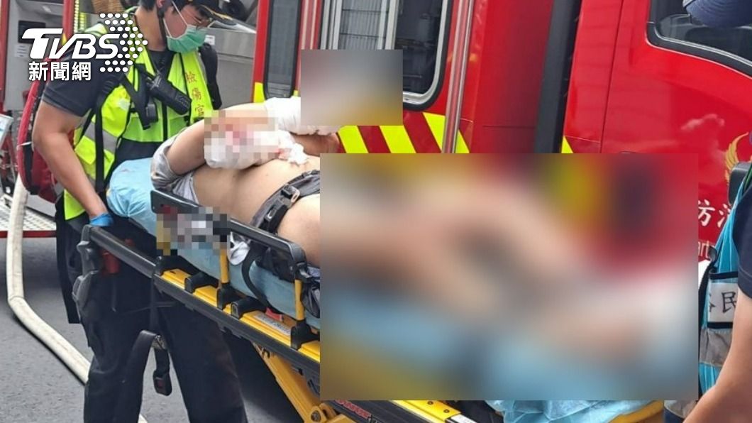 樹林民宅疑氣爆失火!4樓情侶燒燙傷、斷指 7樓男無生命徵象