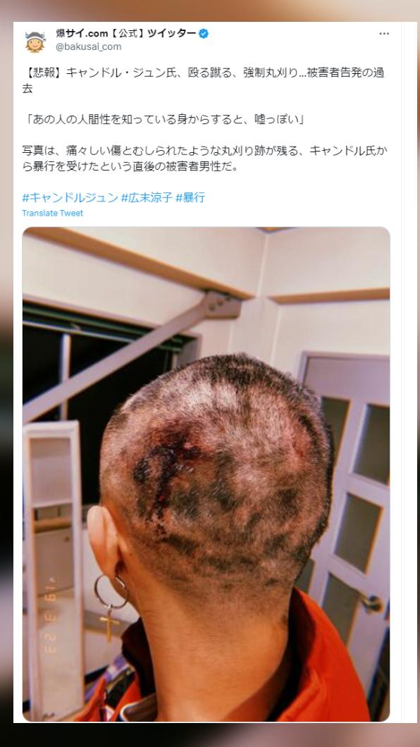 男員工公開他遭井筒順施暴後的照片。（圖／翻攝自推特＠bakusai_com）