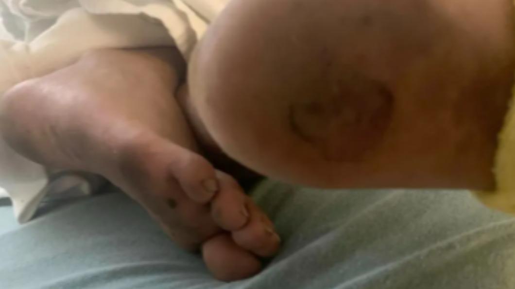 魯迪被發現時身上有多處外傷,頭髮上還有血,不排除受虐可能。(圖/翻攝自《紐約郵報》)