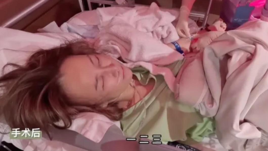 李玟遺體將在8月1日火化。圖為李玟生前左腿做開刀手術。(圖/翻攝自微博)
