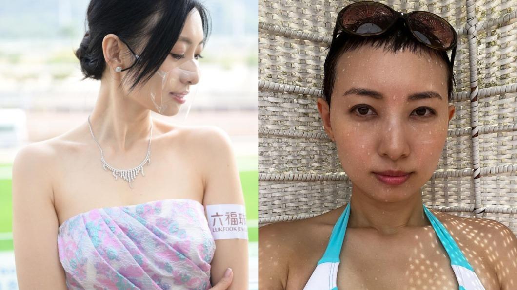 身體亮紅燈?選美女星「剃光頭、戴假髮」 本人吐心聲:不如坦然吧