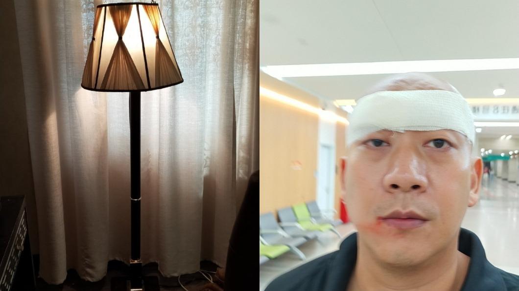 男星拍張藝謀新作出意外! 落地燈砸臉濺血「險成獨眼龍」
