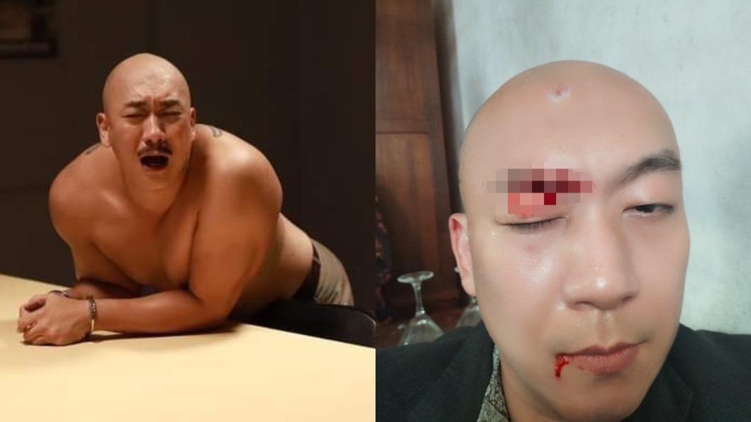 李嘉被落地燈砸到眉骨,當場血流如注。(圖/翻攝自李嘉微博)