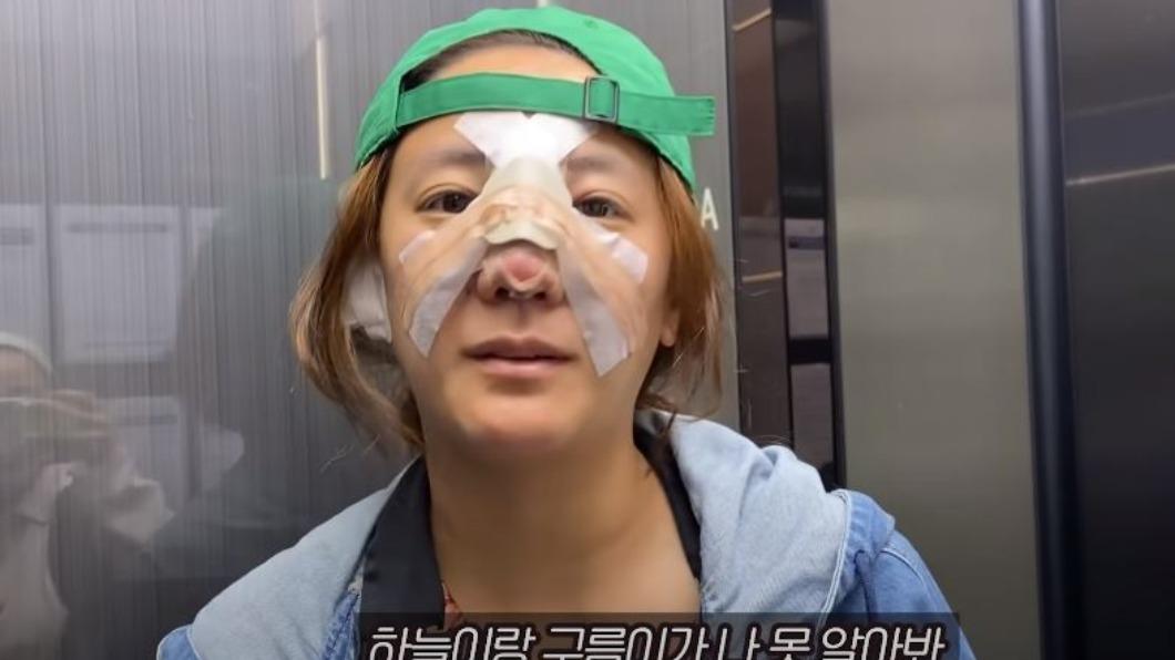 高恩雅術後雖一度難以呼吸、進食,但未來終於不用再受後遺症所苦。(圖/翻攝自「방가네」YT)