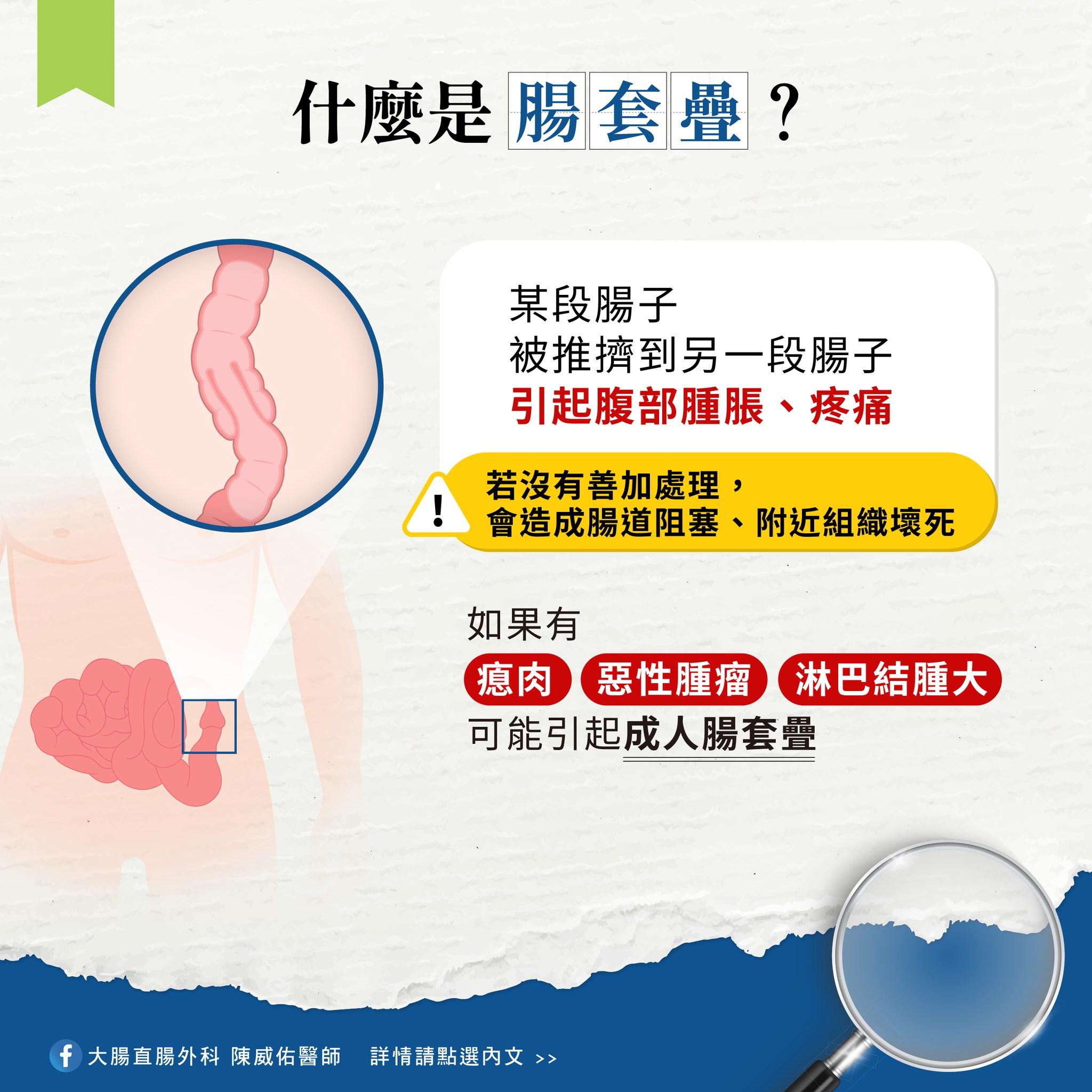 圖/大腸直腸外科 陳威佑醫師授權提供