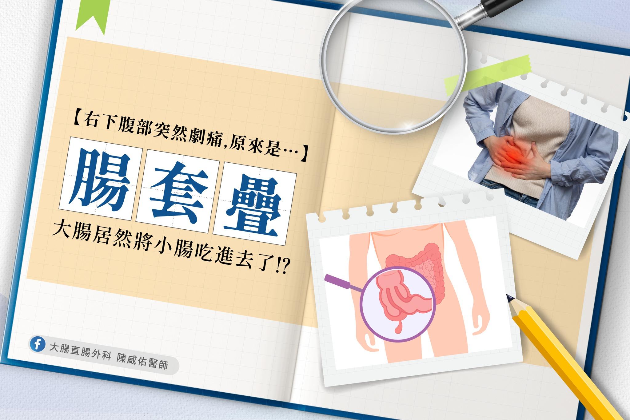 圖/大腸直腸外科 陳威佑醫師授權提供