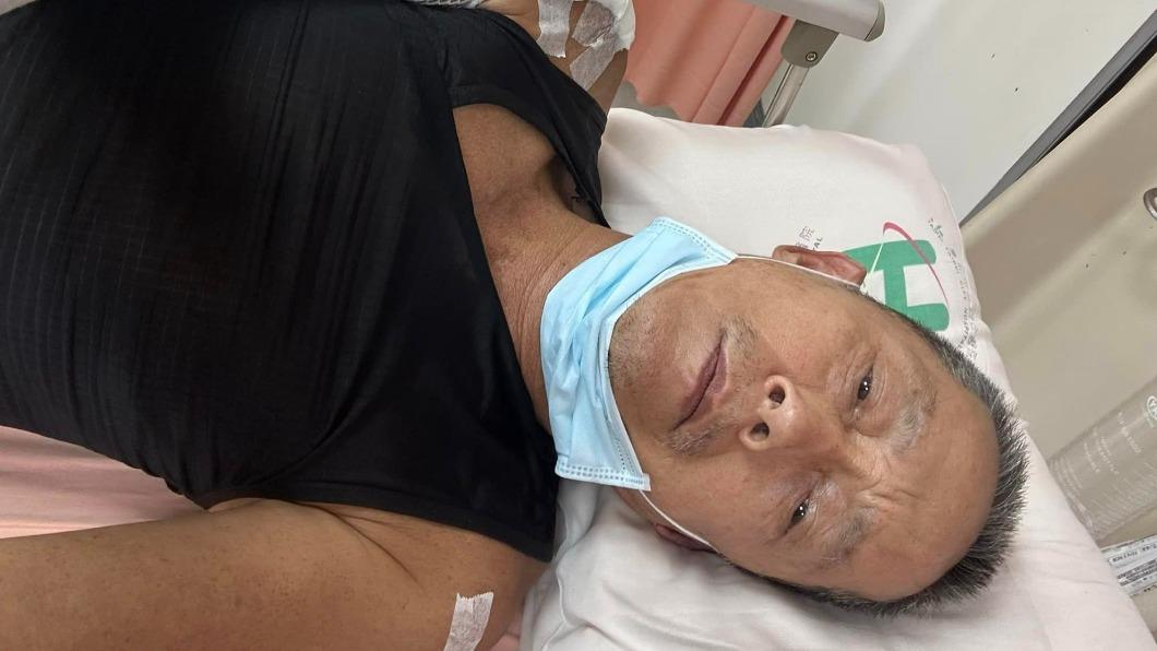 本土劇男星才車禍好轉!驚爆拍戲遭砸險失明「從此退出演藝圈」