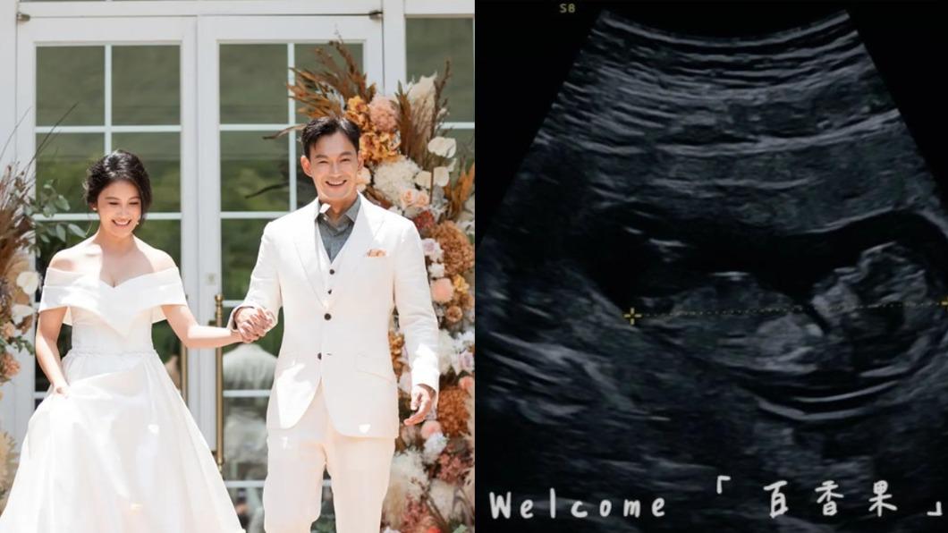 威廉妻懷孕停工超失落!收入現況曝 被判「子宮外孕」恐流產哭了
