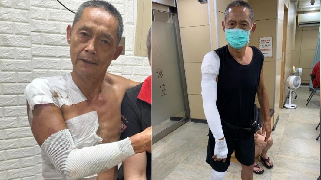 本土劇男星一早車禍!竟「失明」送急診 肋骨重挫傷