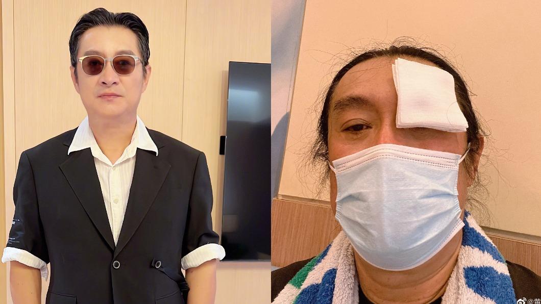 黃安先前因左眼視網膜剝哩,回台動刀休養數月後才返回福州住處。(圖/翻攝自黃安微博)