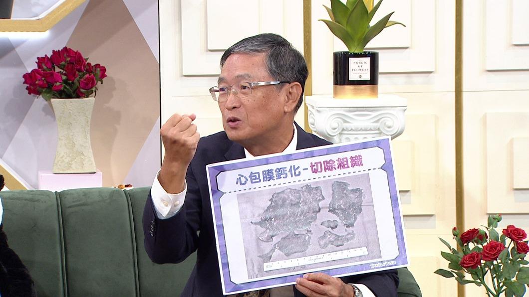 馬西屏因心包膜鈣化進行心臟手術,切除下來的組織猶如牛排一般大。(圖/年代提供)