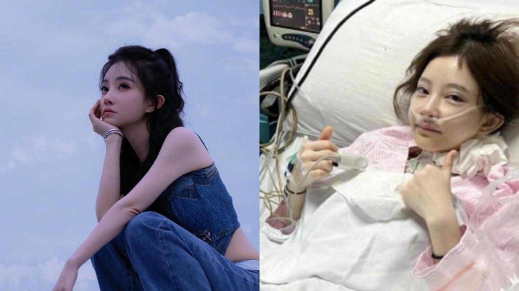 馮提莫「甲狀腺癌末」!醫示警6症狀當心:沙啞是前兆
