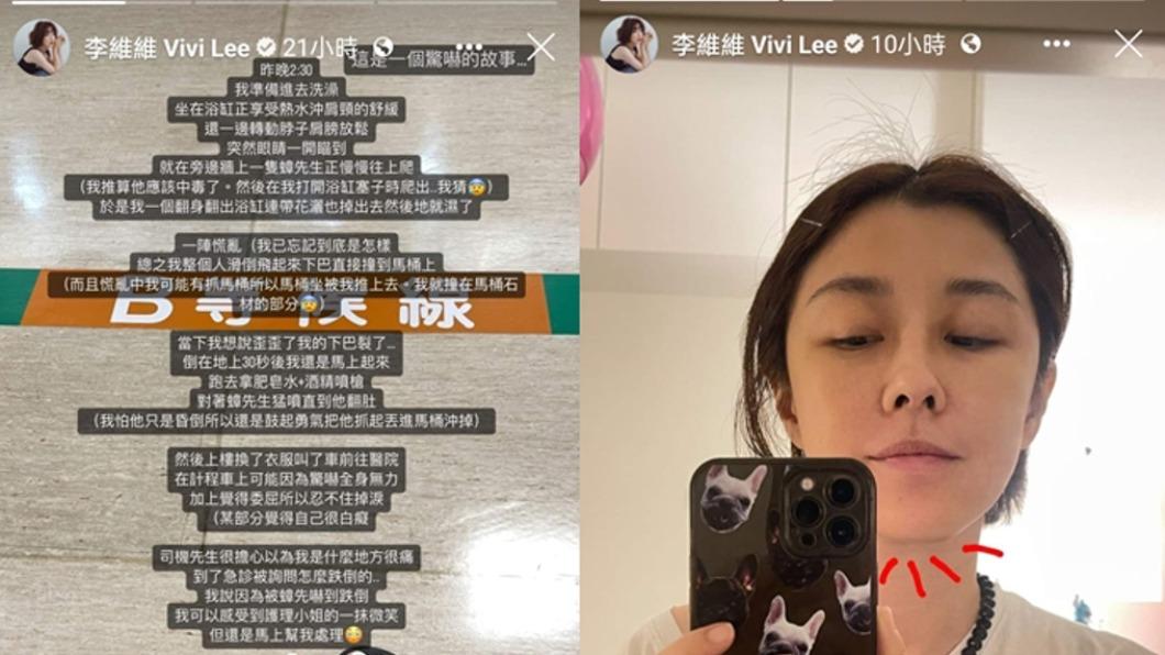 李維維在浴室滑倒下巴撞馬桶。(圖/翻攝自李維維IG)