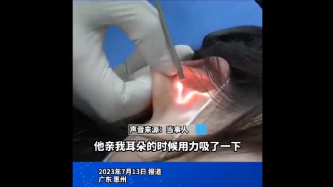 醫生表示，女子的耳膜會被親破，可能是因為男方吮吸力度過大導致的。（圖／翻攝自濟寧新聞網微博）