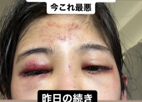 高橋知成多病纏身。(圖/翻攝自IG)