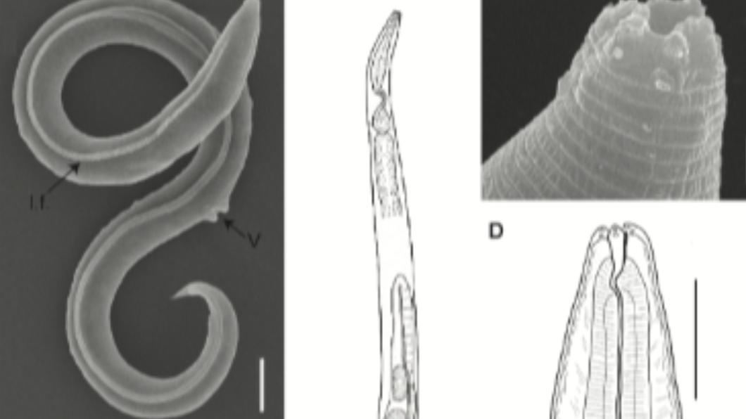 線蟲凍土冰封4.6萬年甦醒 科學家憂「古代病菌」復活