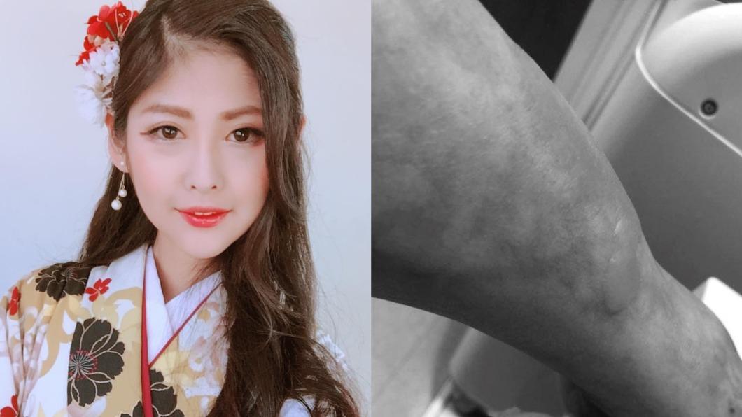 30歲女星驚傳驟逝!生前「4病纏身」暴瘦 最後貼文曝惹淚崩