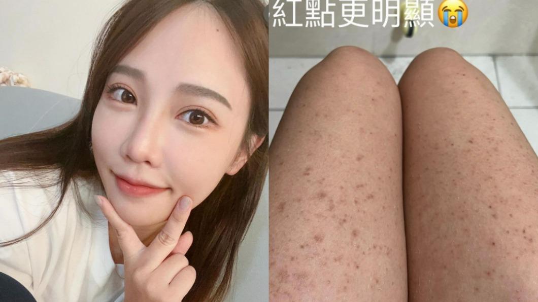 「重機女神」驚罹絕症!醫師斷言「這輩子都不會好」:沒救了