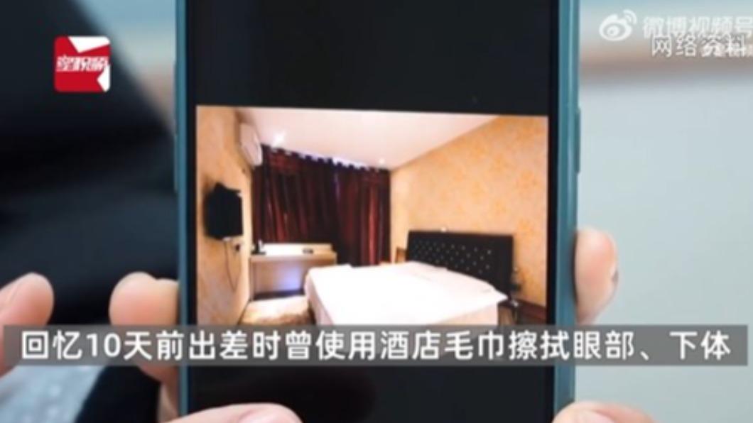 李男曾用飯店毛巾擦拭全身，懷疑因此染病。（圖／翻攝自@猛瑪新聞　微博）