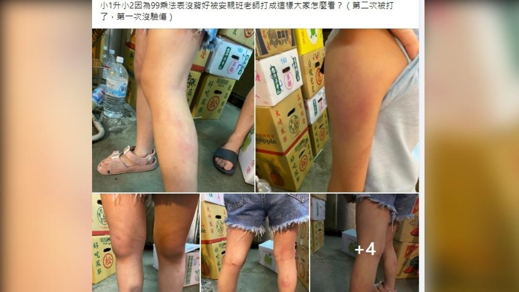 小1女童背不出「99乘法」遭暴打全身 家屬怒告安親班