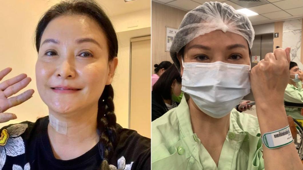 資深女星傳輕生「巨癌復發」！惡性葉狀肉瘤　死亡率飆32％