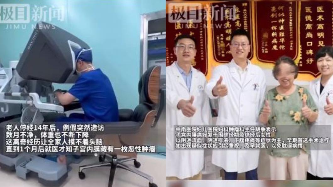 醫師發現蔣婦子宮內膜長了一顆腫瘤,所幸在經過切除手術治療後已康復出院。(圖/翻攝自微博)
