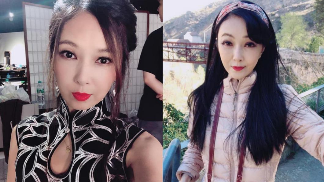 美魔女痛訴遭家暴20年!被打到「臉腫像豬」險死亡 不驗傷原因曝
