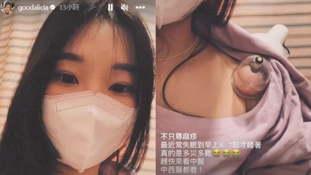 除了蕁麻疹外,愛莉莎莎還為了解決失眠問題而尋求中醫協助。(圖/翻攝自愛莉莎莎IG)