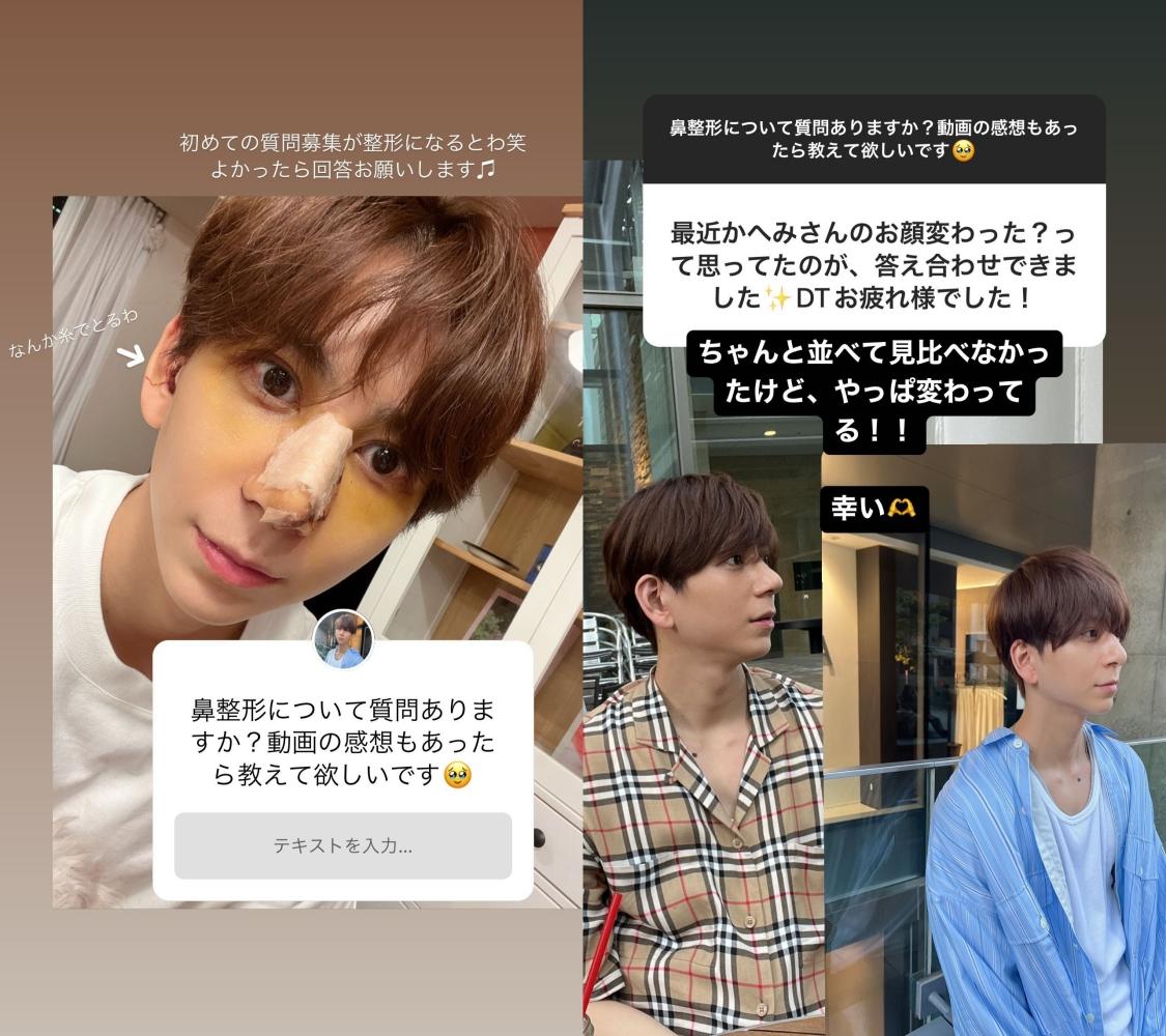 Kahemi坦承曾經隆鼻,還幫粉絲解惑關於手術的種種。(圖/翻攝自Kahemi IG)