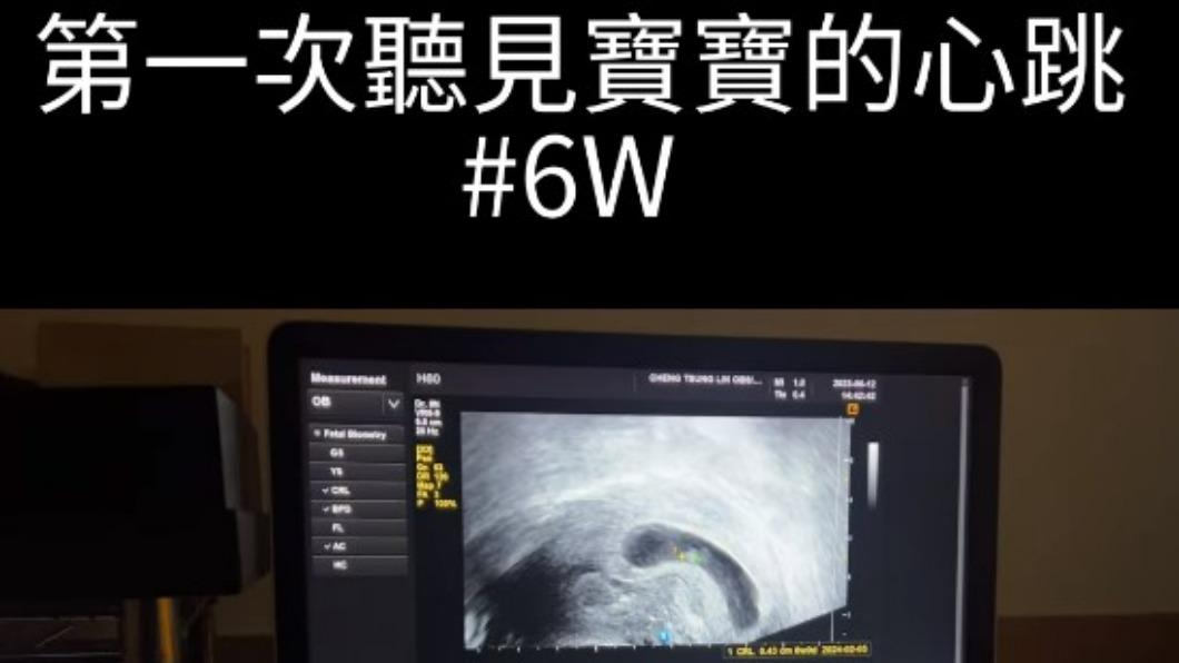 洪詩聽見寶寶心跳忍不住落淚。(圖/翻攝自洪詩 IG)