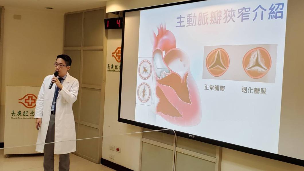 林口長庚紀念醫院心臟血管外科副主任陳紹緯介紹。(圖/院方提供)