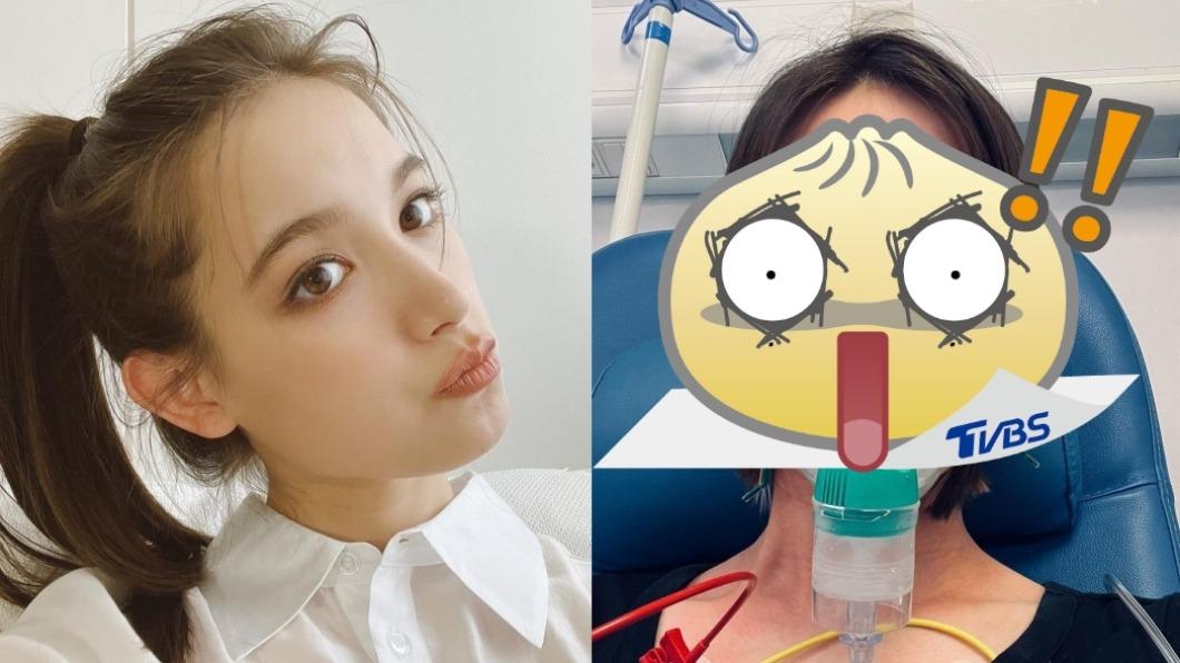 24歲混血女主播過敏性休克! 緊急送醫「全臉腫成豬頭」照片曝