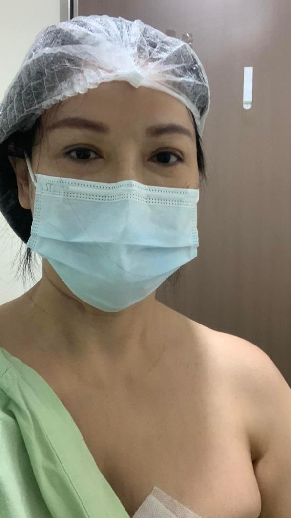 王小芬今年5月決割除左胸的腫瘤。（圖／翻攝自王小芬臉書）
