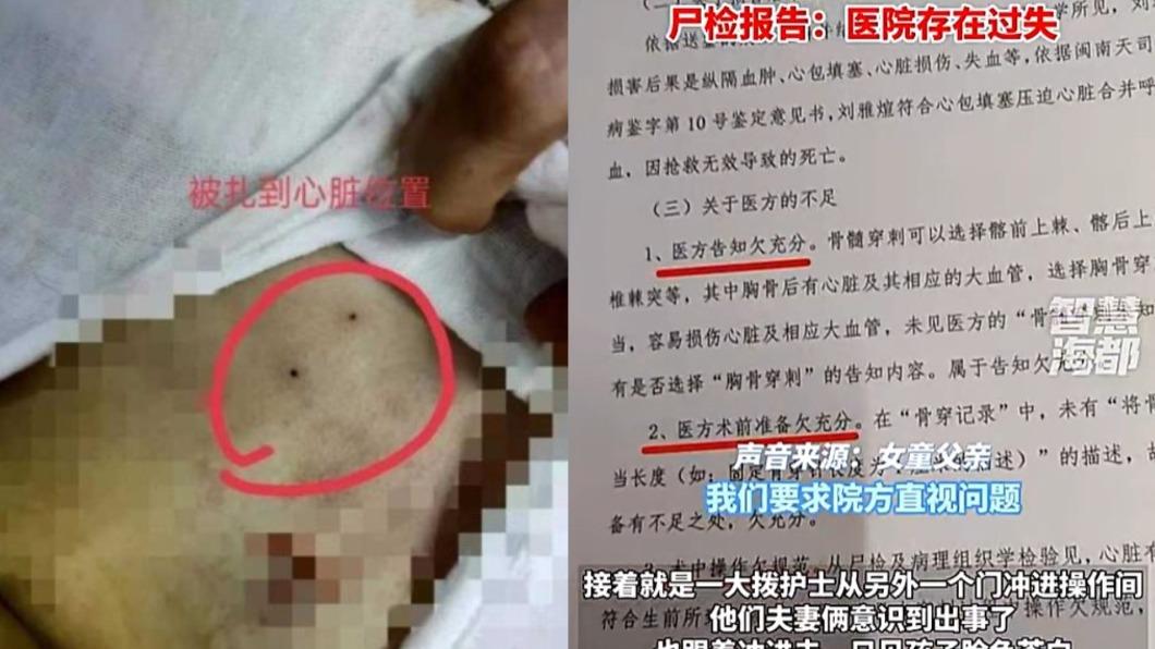 大陸女童穿刺遭刺破心臟。(圖/翻攝自@拆台CT 微博)