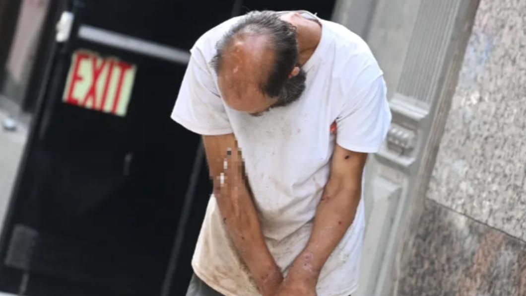 紐約大蘋果成毒窟?癮居子手臂滿血跡、當街注射畫面曝