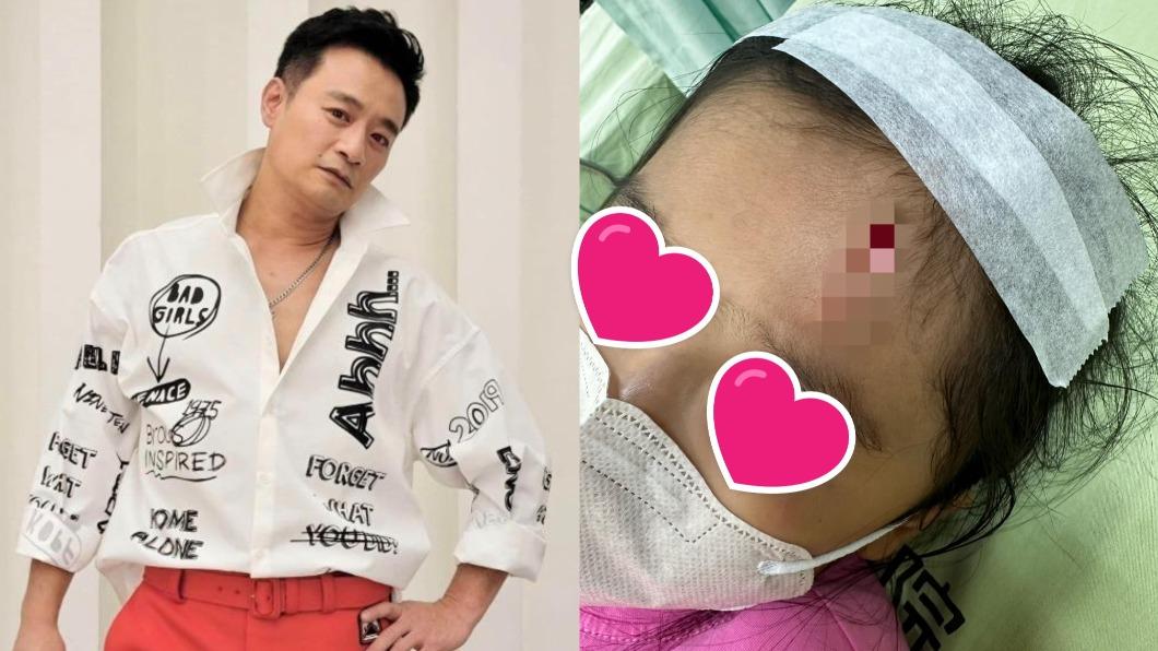本土劇男星4歲愛女送醫!不慎撞柱「頭破鮮血直流」 最新傷勢曝