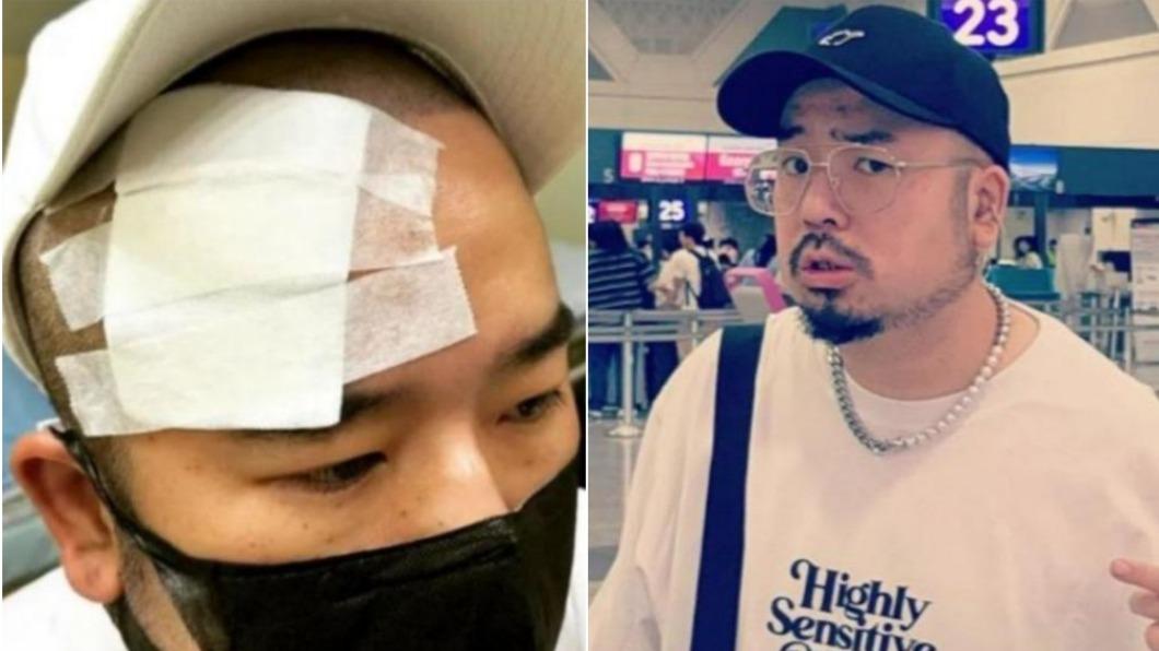 比癌症轉移還痛!36歲男星「臉長皮蛇如火燒」醫警告:恐腦中風