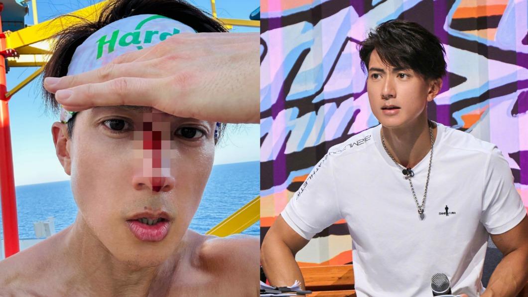 吳尊郵輪上出意外！「血流滿面」驚人傷勢曝光　帥臉破相