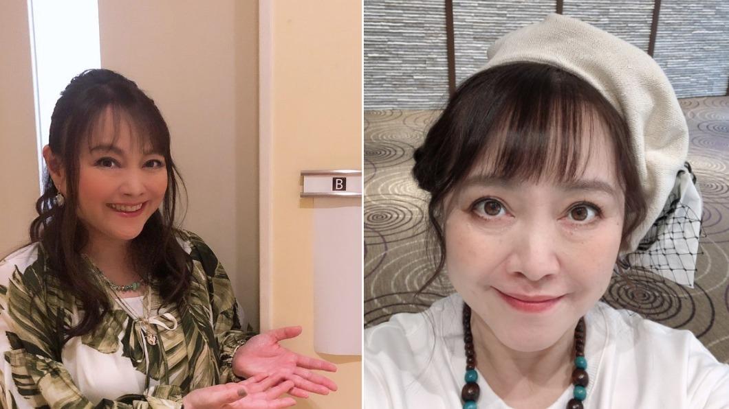 歌后驚傳「腦溢血搶救」！40週年演唱會急喊卡　術後情況曝
