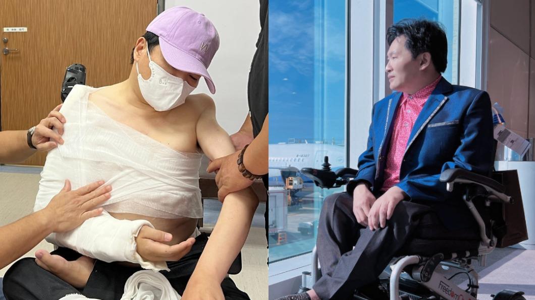 57歲男星粉碎性骨折痛喊「萬蟻鑽骨」 憔悴臥床照曝光