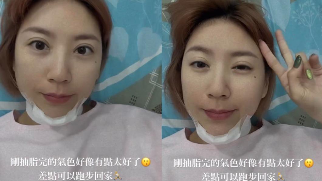 DJ妖嬌進行腹部以及下巴抽脂，術後氣色相當好。（圖／翻攝自DJ妖嬌IG）