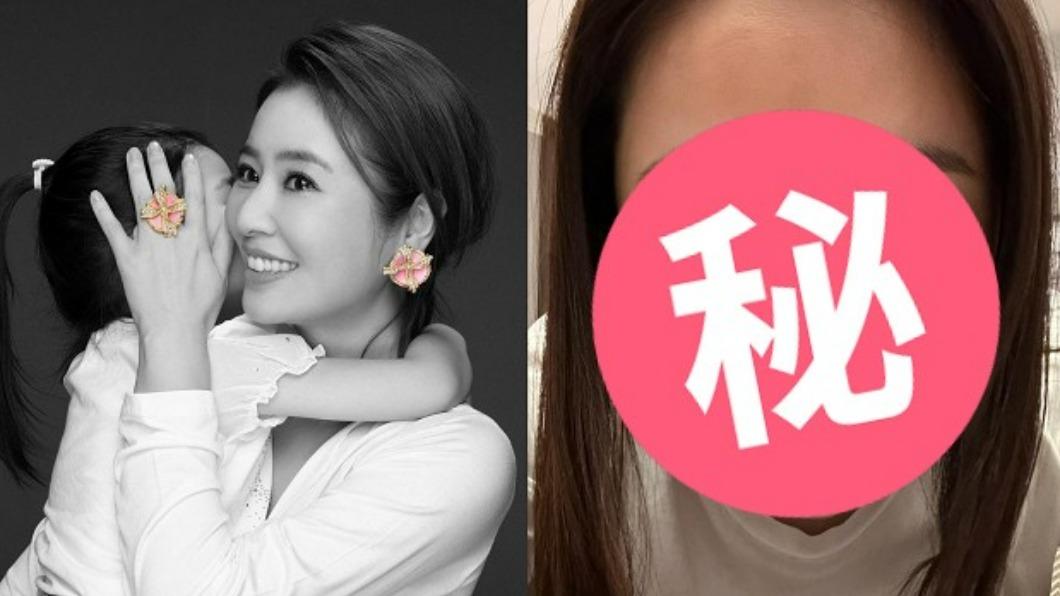 林心如滿臉黑斑！公開「崩壞照」竟笑喊：整個臉都是你的畫布