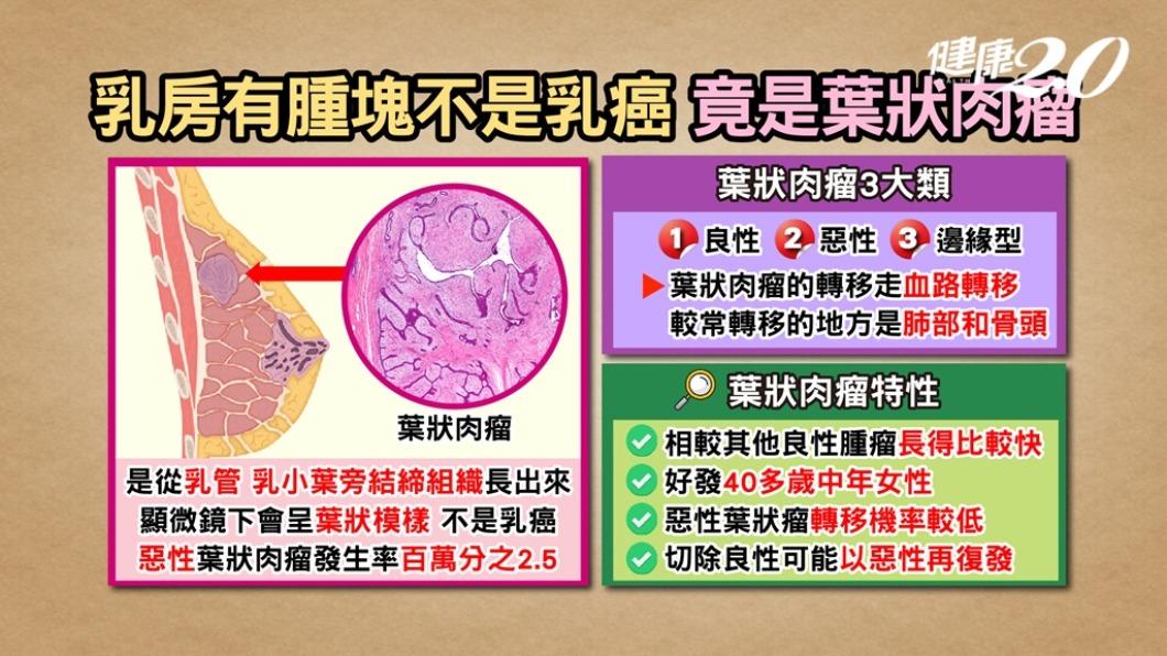 葉狀肉瘤多為良性,發生狀況和一般乳房腫瘤及乳癌不同。(圖/健康2.0)
